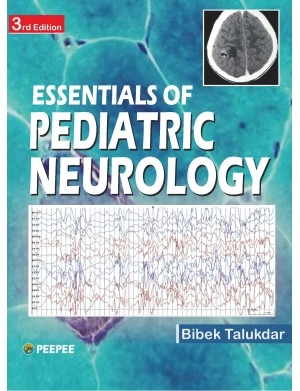 Essentials of Pediatric Neurology