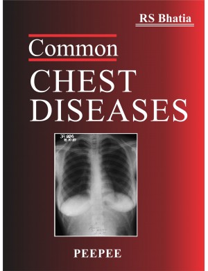Common Chest Diseases