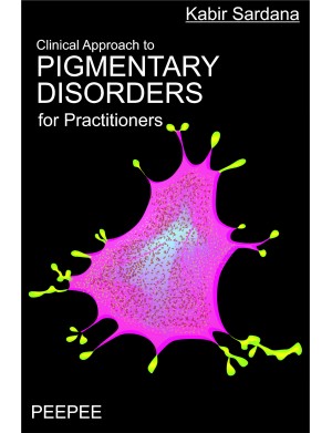 Clinical Approach to Pigmentary Disorders