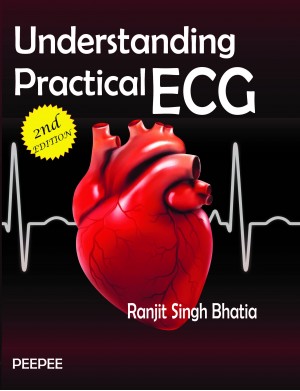 Understanding Practical ECG