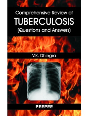 Comprehensive Review of Tuberculosis