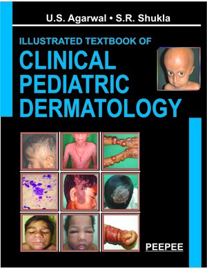 Illustrated Textbook of Clinical Paediatric Dermatology