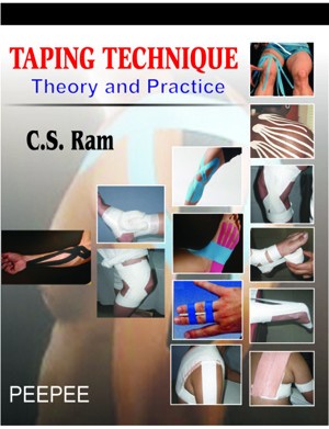 Taping Technique