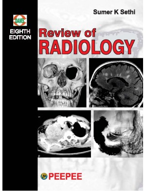 Review of Radiology, 8/e