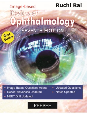 Review of Ophthalmology, 7/e
