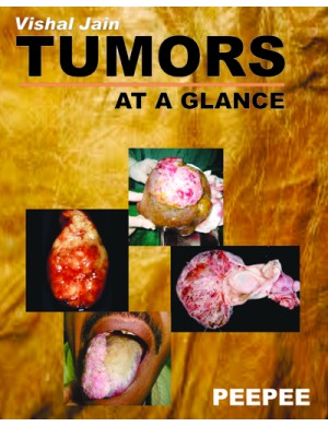 TUMORS AT A GLANCE for DM oncology