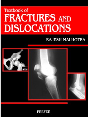 Textbook OF FRACTURE & DISLOCATION 