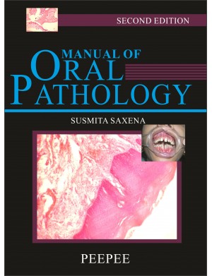 Manual of Oral Pathology - 2/e